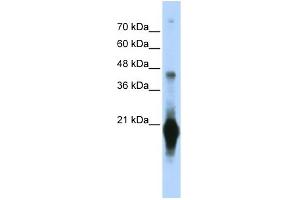 WB Suggested Anti-C17orf49 Antibody Titration: 0. (C17orf49 Antikörper  (Middle Region))