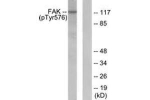 Western blot analysis of extracts from NIH-3T3 cells, using FAK (Phospho-Tyr576) Antibody. (FAK Antikörper  (pTyr576))