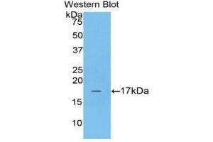 Western blot analysis of the recombinant protein. (Adrenomedullin Antikörper  (AA 35-171))