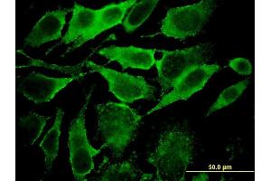 Immunofluorescence of monoclonal antibody to YKT6 on HeLa cell. (YKT6 Antikörper  (AA 99-198))