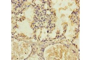 Immunohistochemistry of paraffin-embedded human lung tissue using ABIN7147376 at dilution of 1:100 (PLK1S1 Antikörper  (AA 1-240))