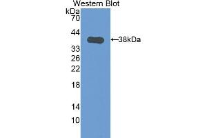 Detection of Recombinant CK1, Mouse using Polyclonal Antibody to Cytokeratin 1 (CK1) (Cytokeratin 1 Antikörper  (AA 189-497))