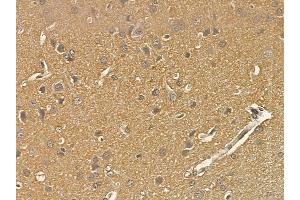 SCLT1 Mouse Monoclonal Antibody at 1/100 staining rat brain tissue by IHC-P. (Sclt1 Antikörper)