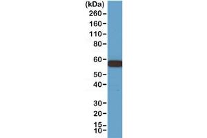 Western blot testing of 293 cell lysate with recombinant AKT1 antibody at 1:1000.