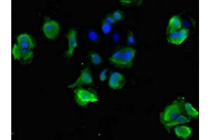 Immunofluorescent analysis of MCF-7 cells using ABIN7170803 at dilution of 1:100 and Alexa Fluor 488-congugated AffiniPure Goat Anti-Rabbit IgG(H+L) (STOML3 Antikörper  (AA 205-291))