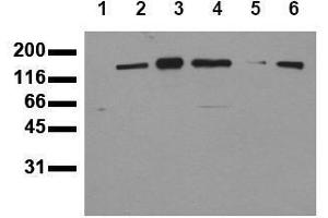 Western Blotting (WB) image for anti-Receptor Tyrosine-Protein Kinase ErbB-3 (ERBB3) (C-Term) antibody (ABIN126793) (ERBB3 Antikörper  (C-Term))