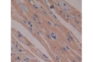 IHC-P analysis of Human Tissue, with DAB staining. (SNX9 Antikörper  (AA 250-595))