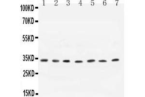 Anti- Cyclin D1 antibody, All Western blottingAll lanes: Anti-CCND1 at 0. (Cyclin D1 Antikörper  (N-Term))