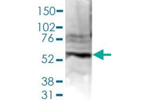Western Blot (Cell lysate) analysis of 40 ug nuclear extracts of Hela cells. (PAPD5 Antikörper  (C-Term))
