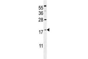 Western Blotting (WB) image for anti-S100 Calcium Binding Protein A4 (S100A4) (AA 1-30) antibody (ABIN3032512)