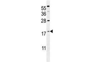 S100A4 antibody western blot analysis in mouse NIH3T3 lysate. (s100a4 Antikörper  (AA 1-30))