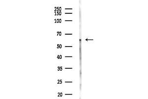 Western blot analysis of lysates from Mouse liver, using K2C1B Antibody at 1/1000 dilution.