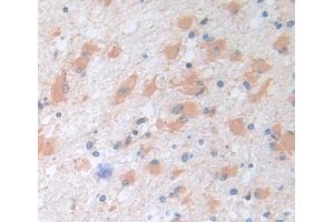 Used in DAB staining on fromalin fixed paraffin- embedded brain tissue (TRIM3 Antikörper  (AA 2-152))