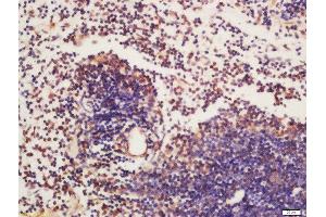 Formalin-fixed and paraffin embedded mouse spleen labeled with Rabbit Anti-BTK (Tyr223) Polyclonal Antibody, Unconjugated  at 1:200 followed by conjugation to the secondary antibody and DAB staining (BTK Antikörper  (pTyr223))