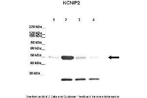 Western Blotting (WB) image for anti-Kv Channel Interacting Protein 2 (KCNIP2) (N-Term) antibody (ABIN2776321)