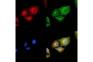 ABIN7094970 and ABIN7099026 staining  cells by IF/ICC.