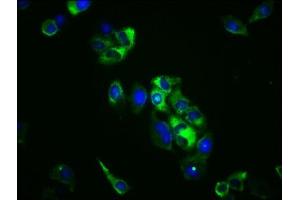 Immunofluorescence staining of Hela cells with ABIN7171265 at 1:100, counter-stained with DAPI.