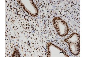 Immunoperoxidase of monoclonal antibody to RBM3 on formalin-fixed paraffin-embedded human endometrium. (RBM3 Antikörper  (AA 1-80))