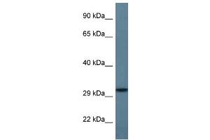WB Suggested Anti-STX11 Antibody Titration: 1. (Syntaxin 11 Antikörper  (C-Term))