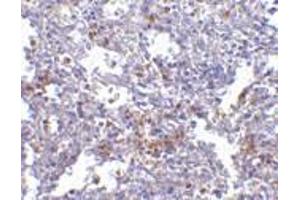 Immunohistochemistry of EVER1 in human spleen with EVER1 antibody at 2.