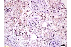 Formalin-fixed and paraffin embedded human kidney labeled with Anti-Wnt16 Polyclonal Antibody, Unconjugated (ABIN1387899) at 1:200 followed by conjugation to the secondary antibody and DAB staining (WNT16 Antikörper  (AA 220-265))