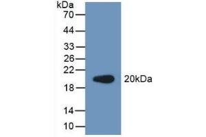 Detection of Recombinant PCPE2, Human using Polyclonal Antibody to Procollagen C Proteinase Enhancer 2 (PCPE2) (PCOLCE2 Antikörper  (AA 297-415))