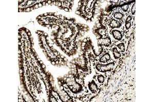 IHC analysis of DDX5 using anti-DDX5 antibody (ABIN7602561). (DDX5 Antikörper  (AA 85-328))