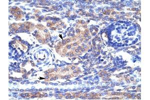 Immunohistochemistry (IHC) image for anti-Potassium Voltage-Gated Channel, Shaker-Related Subfamily, beta Member 3 (KCNAB3) (N-Term) antibody (ABIN630058)