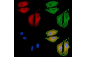 ABIN6260504 and ABIN6279263 staining  cells by IF/ICC. (CATSPER1 Antikörper  (N-Term))