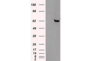 Image no. 5 for anti-Checkpoint Kinase 2 (CHEK2) antibody (ABIN1497498) (CHEK2 Antikörper)