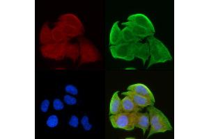 ABIN6257620 and ABIN6275306 staining Hela cells(30 min of UV treatment) by IF/ICC. (NEGR1 Antikörper  (Internal Region))