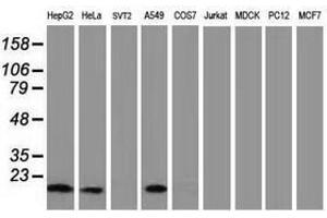 Image no. 6 for anti-Destrin (Actin Depolymerizing Factor) (DSTN) antibody (ABIN1497910) (Destrin Antikörper)