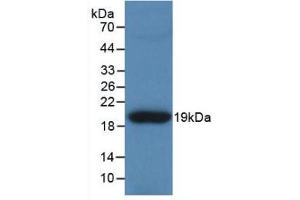 Western blot analysis of recombinant Human TNC. (TNC Antikörper  (AA 49-181))