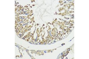 Immunohistochemistry of paraffin-embedded rat testis using H antibody (ABIN7267593) at dilution of 1:100 (40x lens). (HACE1 Antikörper  (AA 1-100))