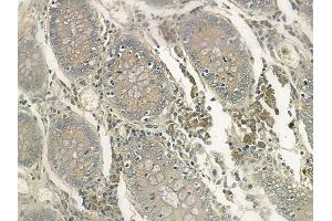 ABIN6263060 and ABIN6272509 at 1/100 staining human normal colon tissue by IHC-P. (MAGEA11 Antikörper  (C-Term))