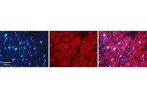 Rabbit Anti-PPIB Antibody   Formalin Fixed Paraffin Embedded Tissue: Human heart Tissue Observed Staining: Cytoplasmic Primary Antibody Concentration: N/A Other Working Concentrations: 1:600 Secondary Antibody: Donkey anti-Rabbit-Cy3 Secondary Antibody Concentration: 1:200 Magnification: 20X Exposure Time: 0.