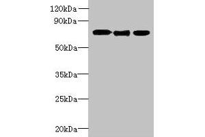 Western blot All lanes: SLC23A1 antibody at 3 μg/mL Lane 1: A549 whole cell lysate Lane 2: Mouse liver tissue Lane 3: Mouse kidney tissue Secondary Goat polyclonal to rabbit IgG at 1/10000 dilution Predicted band size: 65, 66, 29 kDa Observed band size: 65 kDa (SLC23A1 Antikörper  (AA 173-259))
