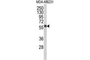 Western blot analysis of ALDH3B1 Antibody (Center) in MDA-MB231 cell line lysates (35ug/lane). (ALDH3B1 Antikörper  (Middle Region))