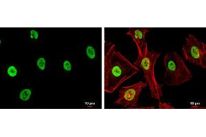 ICC/IF Image SAE1 antibody detects SAE1 protein at nucleus by immunofluorescent analysis.