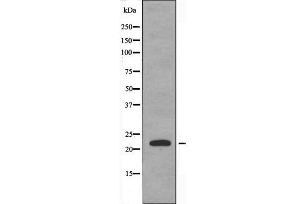 DTYMK antibody  (Internal Region)