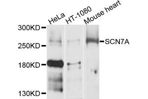 Western blot analysis of extracts of various cells, using SCN7A antibody. (SCN7A Antikörper)
