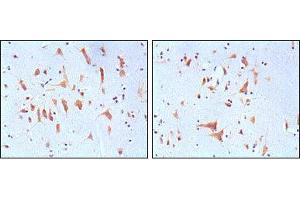 Immunohistochemical analysis of paraffin-embedded human brain tissues, showing cytoplasmic localization with DAB staining using FMR1 mouse mAb. (FMR1 Antikörper)
