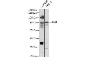 Western blot analysis of extracts of various cell lines, using IC antibody (7500) at 1:1000 dilution. (ICA1 Antikörper  (AA 1-160))