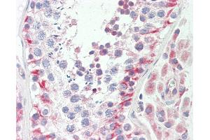 Immunohistochemistry (IHC) image for anti-Ubiquinol-Cytochrome C Reductase Core Protein II (UQCRC2) (AA 235-264) antibody (ABIN1928409)