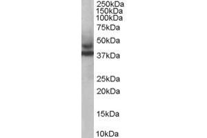 ABIN184954 staining (1ug/ml) of Human Skeletal Muscle lysate (RIPA buffer, 35ug total protein per lane). (TRIM54 Antikörper  (C-Term))