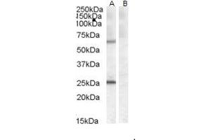 (ABIN238598) (0. (COL4A3BP Antikörper  (AA 662-672))