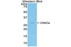 Western Blotting (WB) image for anti-Jagged 2 (JAG2) (AA 709-941) antibody (ABIN3202317) (JAG2 Antikörper  (AA 709-941))