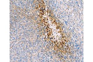 IHC analysis of SLC2A1 using anti-SLC2A1 antibody (ABIN6719416).