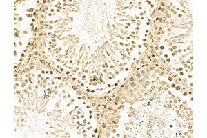 ABIN7094335 and ABIN7098382 at 1/100 staining Rat testis tissue by IHC-P.