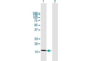 DnaJ (Hsp40) Homolog, Subfamily B, Member 3 (DNAJB3) (AA 1-145) Antikörper